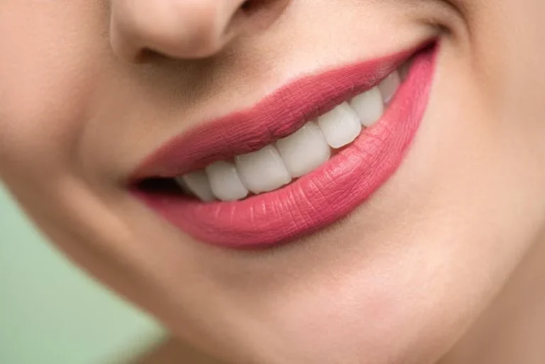 Blanchiment des dents Nyon