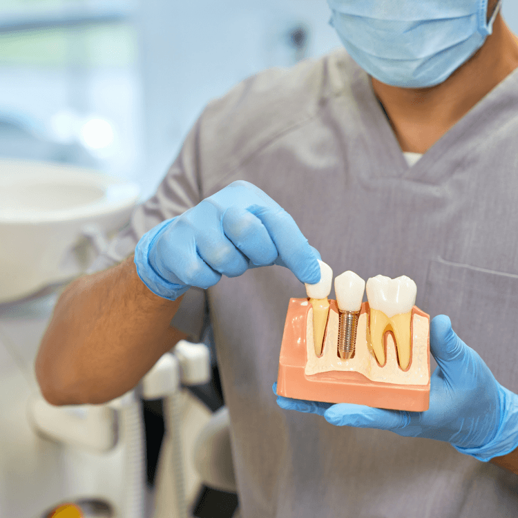 Blog 7 Implant dentaire inséré dans l’os de la mâchoire avec couronne prothétique