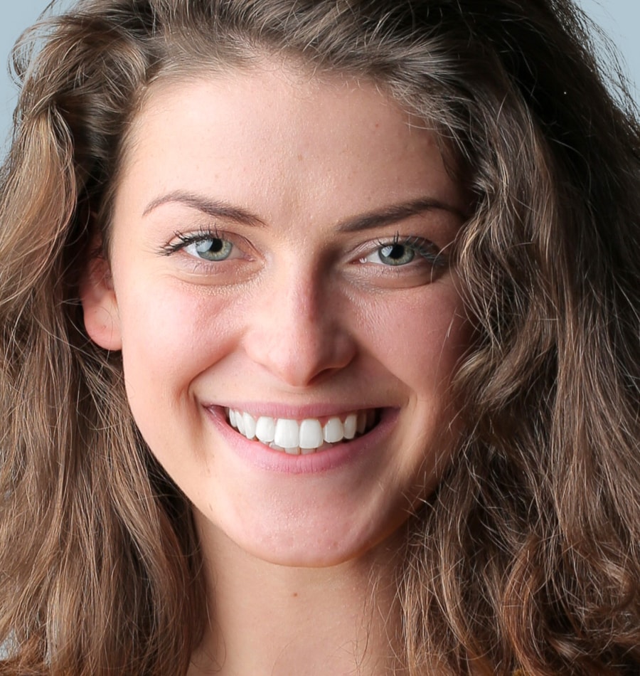 Jeune femme souriant après une pose de facettes dentaires à Nyon réalisée par le Cabinet Dentaire de Nyon.